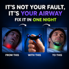Smart Anti-Snore Device